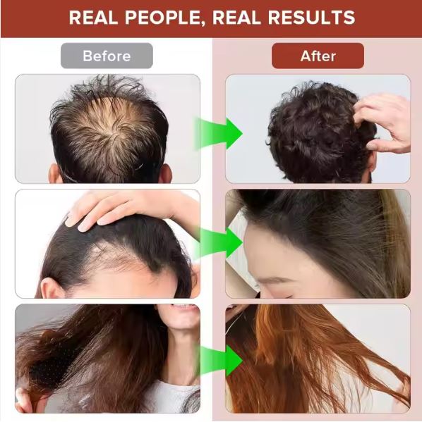 Organic Raw Batana Oil Hair Growth Raw Batana Butter