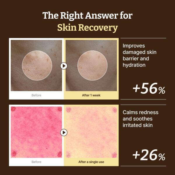 Dr. Reju-All Advanced PDRN Rejuvenating Cream Max – 99% Pure Salmon DNA PDRN Face Moisturizer – Optimal 1200ppm Concentration for Glow Skin – Korean Anti-Aging Skin Care Face Cream - 60ml